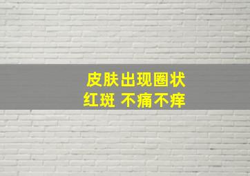 皮肤出现圈状红斑 不痛不痒